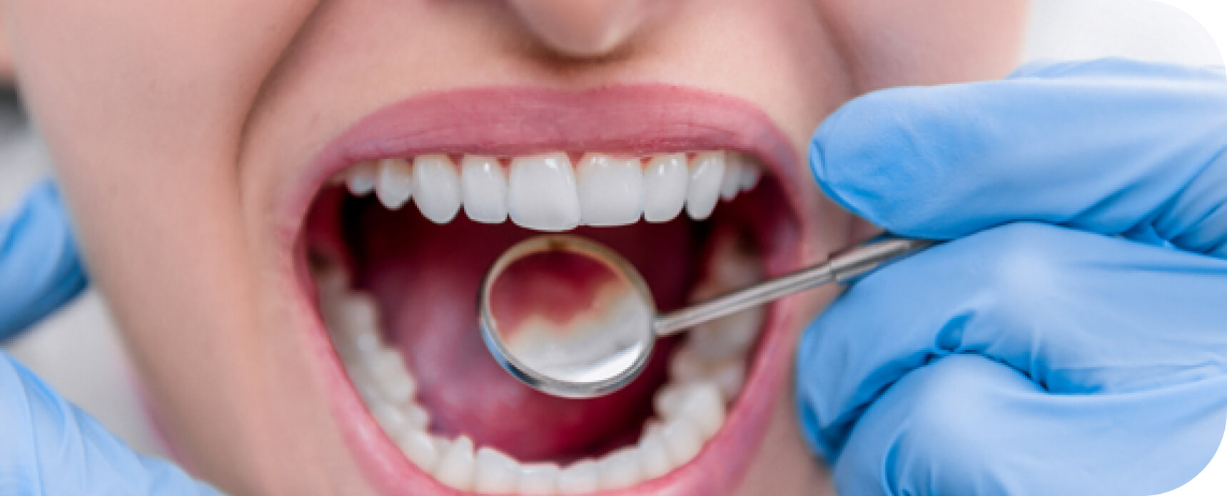 Odontologo revisando dientes